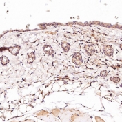 IHC staining of FFPE mouse skin tissue with CD45 antibody. HIER: boil tissue sections in pH6, 10mM citrate buffer, for 10-20 min and allow to cool before testing.