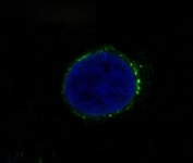 Immunofluorescent staining of FFPE human HT-29 cells with c-Met antibody (green) and DAPI nuclear stain (blue). HIER: steam section in pH6 citrate buffer for 20 min.