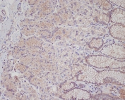 IHC staining of FFPE human stomach tissue with c-Met antibody. HIER: boil tissue sections in pH6, 10mM citrate buffer, for 10-20 min and allow to cool before testing.