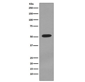 Western blot testing of human T-47D cell lysate with Cytokeratin 7 antibody. Predicted molecular weight ~51 kDa.