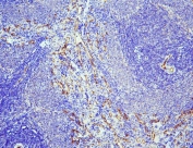 IHC staining of FFPE rat spleen with eNOS antibody. HIER: boil tissue sections in pH6, 10mM citrate buffer, for 20 min and allow to cool before testing.