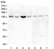 Western blot testing of 1) human placenta, 2) human K562, 3) human HepG2, 4) human ThP-1, 5) rat kidney, 6) mouse kidney and 7) mouse small intestine with eNOS antibody. Predicted molecular weight ~133 kDa.