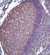 IHC staining of FFPE human tonsil with BHC80 antibody. HIER: boil tissue sections in pH6, 10mM citrate buffer, for 20 min and allow to cool before testing.