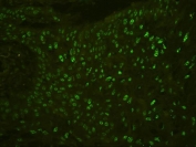Immunofluorescent staining of FFPE human esophagus squama with BHC80 antibody. HIER: boil tissue sections in pH6, 10mM citrate buffer, for 20 min and allow to cool before testing.