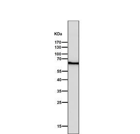 Western blot testing of human HaCaT cell lysate with Keratin 5 antibody. Predicted molecular weight: 58-62 kDa.
