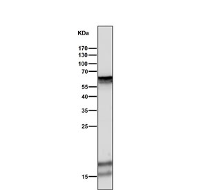 Western blot testing of human ThP-1 cell lysate with Keratin 5 antibody. Predicted molecular weight: 58-62 kDa.