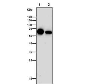 Western blot testing of mouse 1) heart and 2) liver tissue lysate with Keratin 5 antibody. Predicted molecular weight: 58-62 kDa.