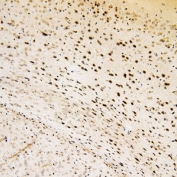 IHC staining of FFPE mouse brain with SOX15 antibody. HIER: boil tissue sections in pH6, 10mM citrate buffer, for 20 min and allow to cool before testing.