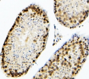 IHC staining of FFPE mouse testis with SOX15 antibody. HIER: boil tissue sections in pH6, 10mM citrate buffer, for 20 min and allow to cool before testing.