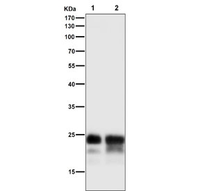 Western blot testing of mouse 1) stomach and 2) pancreas tissue lysate with Mucin-1 antibody at 1:5000 dilution. Expected molecular weight: 17-25 kDa depending on glycosylation level.