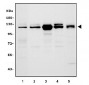 Western blot testing of human 1) HeLa, 2) Jurkat, 3) HEK293, 4) K562 and 5) HL60 cell lysate with BubR1 antibody. Predicted molecular weight ~120 kDa.