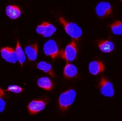 Immunofluorescent staining of FFPE human U-2 OS cells with BubR1 antibody (red) and DAPI nuclear stain (blue). HIER: steam section in pH6 citrate buffer for 20 min.