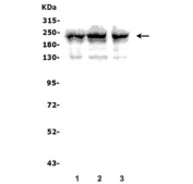 Western blot testing of human 1) U-2 OS, 2) K562 and 3) PC-3 lysate with RICTOR antibody. Predicted molecular weight ~200 kDa.