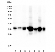 Western blot testing of human 1) HepG2, 2) HL-60, 3) ThP-1 and 4) rat liver, 5) rat RH35, 6) mouse liver and 7) mouse HEPA1-6 lysate with AKR1D1 antibody. Predicted molecular weight ~37 kDa.