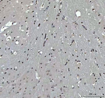 IHC staining of FFPE mouse brain tissue with Menin antibody. HIER: boil tissue sections in pH8 EDTA for 20 min and allow to cool before testing.