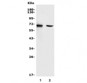 Western blot testing of 1) human U-87 MG and 2) rat lung lysate with MMP2 antibody. Expected molecular weight: ~72 kDa (pro form), ~63 kDa (cleaved form).
