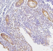 IHC staining of FFPE human appendicitis tissue with CXCR2 antibody. HIER: boil tissue sections in pH8 EDTA for 20 min and allow to cool before testing.