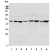 Western blot testing of human 1) placenta, 2) COLO-320, 3) SW620, 4) Caco-2, 5) HEK293, 6) K562, 7) HepG2 and 8) ThP-1 lysate with TSG101 antibody. Predicted molecular weight ~45 kDa.