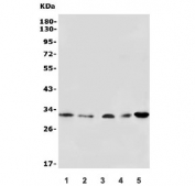 Western blot testing of 1) human K562, 2) human A431, 3) rat heart, 4) rat kidney and 5) mouse heart lysate with VDAC3 antibody. Predicted molecular weight: 31 kDa.