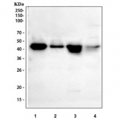 Western blot testing of human 1) HeLa, 2) A431, 3) Raji and 4) HL60 cell lysate with DDB2 antibody. Predicted molecular weight ~48 kDa.