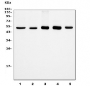 Western blot testing of human 1) HeLa, 2) Jurkat, 3) K562, 4) Raji and 5) HepG2 cell lysate with ETF1 antibody. Predicted molecular weight ~49 kDa.