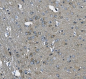 IHC staining of FFPE mouse brain with Stathmin 2 antibody. HIER: boil tissue sections in pH8 EDTA for 20 min and allow to cool before testing.