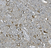 IHC staining of FFPE rat brain with Stathmin 2 antibody. HIER: boil tissue sections in pH8 EDTA for 20 min and allow to cool before testing.