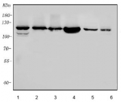 Western blot testing of human 1) MCF7, 2) HeLa, 3) Daudi, 4) HEK293, 5) rat testis and 6) mouse testis lysate with Poly (ADP-ribose) polymerase 1 antibody. Predicted molecular weight ~116 kDa.