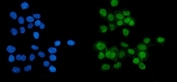 Immunofluorescent staining of FFPE human A431 cells with Poly (ADP-ribose) polymerase 1 antibody (green) and DAPI nuclear stain (blue). HIER: steam section in pH6 citrate buffer for 20 min.