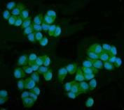 Immunofluorescent staining of FFPE human T-47D cells with Mannose Phosphate Isomerase antibody (green) and DAPI nuclear stain (blue). HIER: steam section in pH6 citrate buffer for 20 min.