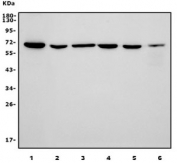 Western blot testing of human 1) A549, 2) SW620, 3) Raji, 4) rat liver, 5) rat RH35 and 6) mouse liver lysate with Transketolase antibody. Predicted molecular weight ~68 kDa.