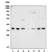 Western blot testing of human 1) Jurkat, 2) HEK293, 3) MCF7, 4) T47D, 5) A549 and 6) rat liver lysate with CASP7 antibody. Expected molecular weight ~34 kDa (full length).
