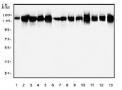 Western blot testing of human 1) placenta, 2) A549, 3) HEK293, 4) HeLa, 5) K562, 6) U937, 7) HepG2 and rat 8) liver, 9) brain, 10) testis and mouse 11) liver, 12) brain and 13) testis tissue lysate with PFAS antibody. Predicted molecular weight ~145 kDa.