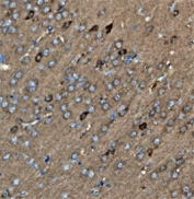 IHC staining of FFPE rat brain tissue with Glutamic-oxaloacetic transaminase 1 antibody. HIER: boil tissue sections in pH8 EDTA for 20 min and allow to cool before testing.
