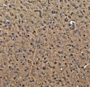 IHC staining of FFPE mouse brain tissue with Glutamic-oxaloacetic transaminase 1 antibody. HIER: boil tissue sections in pH8 EDTA for 20 min and allow to cool before testing.