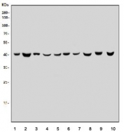 Western blot testing of human 1) placenta, 2) T-47D, 3) HepG2, 4) Caco-2, 5) HL60, 6) K562, 7) HeLa, 8) rat brain, 9) mouse brain and 10) mouse liver tissue lysate with Glutamic-oxaloacetic transaminase 1 antibody. Predicted molecular weight ~41 kDa.