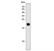 Western blot testing of human Caco-2 cell lysate with Claudin 2 antibody. Predicted molecular weight ~25 kDa.