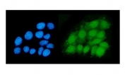 Immunofluorescent staining of FFPE human MCF7 cells with Deoxyhypusine synthase antibody (green) and DAPI nuclear stain (blue). HIER: steam section in pH6 citrate buffer for 20 min.