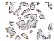 IHC staining of FFPE human placental tissue with GOLM1 antibody. HIER: boil tissue sections in pH8 EDTA for 20 min and allow to cool before testing.