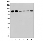 Western blot testing of human 1) U-87 MG, 2) Caco-2, 3) rat testis, 4) rat brain, 5) mouse brain and 6) mouse Neuro-2a cell lysate with GOLM1 antibody. Predicted molecular weight ~73 kDa.