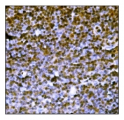 IHC staining of FFPE mouse lymph node tissue with Protein PML antibody. HIER: boil tissue sections in pH8 EDTA for 20 min and allow to cool before testing.