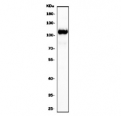 Western blot testing of human Jurkat cell lysate with SLFN11 antibody. Predicted molecular weight ~103 kDa.