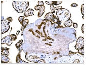 IHC staining of FFPE human placental tissue with IGF2R antibody. HIER: boil tissue sections in pH8 EDTA for 20 min and allow to cool before testing.