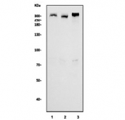 Western blot testing of human 1) HeLa, 2) U-87 MG and 3) HepG2 cell lysate with IGF2R antibody. Predicted molecular weight ~274 kDa.