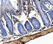 IHC staining of FFPE mouse colon tissue with Integrin Linked Kinase antibody. HIER: boil tissue sections in pH8 EDTA for 20 min and allow to cool before testing.