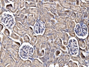 IHC staining of FFPE rat kidney tissue with Integrin Linked Kinase antibody. HIER: boil tissue sections in pH8 EDTA for 20 min and allow to cool before testing.