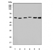 Western blot testing of 1) human HeLa, 2) human HEK293, 3) rat kidney, 4) rat spleen, 5) rat PC-12 and 6) mouse spleen lysate with Integrin Linked Kinase antibody. Expected molecular weight: 51-59 kDa.