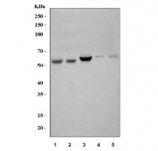 Western blot testing of human 1) HepG2, 2) HeLa, 3) RT4, 4) A431 and 5) U-2 OS cell lysate with LACTB antibody. Expected molecular weight: 54-60 kDa.