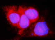 Immunofluorescent staining of FFPE human A431 cells with LACTB antibody (red) and DAPI nuclear stain (blue). HIER: steam section in pH6 citrate buffer for 20 min.
