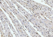 IHC staining of FFPE rat heart tissue with Cyclophilin E antibody. HIER: boil tissue sections in pH8 EDTA for 20 min and allow to cool before testing.
